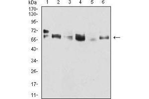 Western Blotting (WB) image for anti-Keratin 5 (KRT5) (AA 258-357) antibody (ABIN5542459)