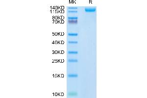 SARS-COV-2 Spike S1 (N501Y) on Tris-Bis PAGE under reduced condition. (SARS-CoV-2 Spike S1 Protein (N501Y) (His tag))