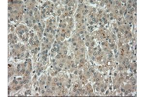 Image no. 10 for anti-Budding Uninhibited By Benzimidazoles 1 Homolog beta (Yeast) (BUB1B) antibody (ABIN1497000) (BUB1B antibody)