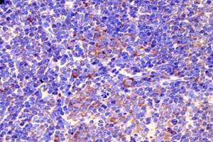 Immunohistochemistry analysis of paraffin-embedded mouse prefrontal lobe using GPR83 (ABIN7074000) at dilution of 1: 800 (GPR83 antibody)