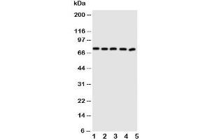 Western blot testing of ABCG5 antibody and Lane 1:  MCF-7;  2: A549;  3: HT1080;  4: U87;  5: SKOV cell lysate.