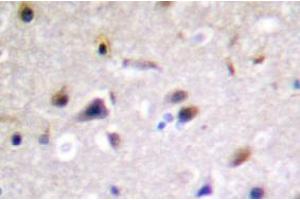 Image no. 2 for anti-Dystrophin Related Protein 2 (DRP2) antibody (ABIN317802) (DRP2 antibody)