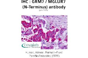 Image no. 1 for anti-Glutamate Receptor, Metabotropic 7 (GRM7) (Extracellular Domain), (N-Term) antibody (ABIN1735280) (GRM7 antibody  (Extracellular Domain, N-Term))