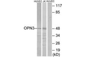 Western blot analysis of extracts from HuvEc/Jurkat cells, using OPN3 Antibody. (OPN3 antibody  (AA 161-210))