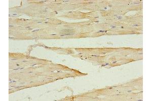 Immunohistochemistry of paraffin-embedded human skeletal muscle tissue using ABIN7149554 at dilution of 1:100 (DAPK2 antibody  (AA 222-370))