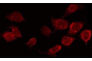 ABIN6267388 staining Hela by IF/ICC. (ATF2 antibody  (pSer94, pSer112))
