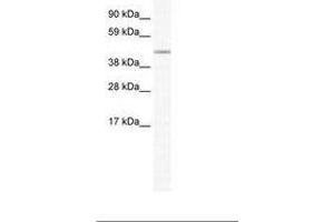 Image no. 1 for anti-Forkhead Box D1 (FOXD1) (AA 116-165) antibody (ABIN202563) (FOXD1 antibody  (AA 116-165))