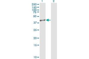 Western Blot analysis of TRIB3 expression in transfected 293T cell line by TRIB3 monoclonal antibody (M05), clone 2F7. (TRIB3 antibody  (AA 56-145))