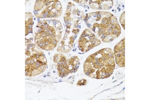 Immunohistochemistry of paraffin-embedded human stomach using BMPR2 antibody (ABIN7265906) at dilution of 1:100 (40x lens). (BMPR2 antibody  (AA 27-150))