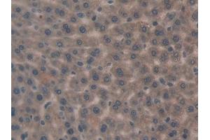 Immunohistochemistry (IHC) image for anti-GATA Binding Protein 4 (GATA4) (AA 228-440) antibody (ABIN7431686)