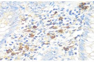 Immunohistochemistry of paraffin-embedded Human appendix using TPSAB1 Polyclonal Antibody at dilution of 1:100 (40x lens). (TPSAB1 antibody)