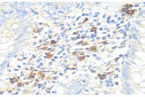 Immunohistochemistry of paraffin-embedded Human appendix using TPSAB1 Polyclonal Antibody at dilution of 1:100 (40x lens).