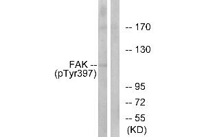 Western blot analysis of extracts from 293cells, treated with EGF (200ng/ml, 30mins), using FAK (Phospho-Tyr397) antibody. (FAK antibody  (pTyr397))