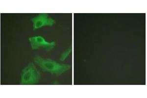 Immunofluorescence analysis of HeLa cells, treated with TNF-a (20nM, 15mins), using HSP90B (epitope around residue 254) antibody (ABIN5976154). (HSP90AB1 antibody  (Ser254))