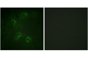 Immunofluorescence analysis of COS7 cells, using DAPK1 (Ab-308) Antibody. (DAP Kinase 1 antibody  (AA 274-323))
