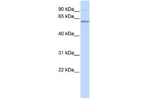 WB Suggested Anti-TRIM16 Antibody Titration:  0. (TRIM16 antibody  (N-Term))