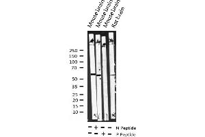 Western blot analysis of Phospho-Dab1 (Tyr232) expression in various lysates (DAB1 antibody  (pTyr232))
