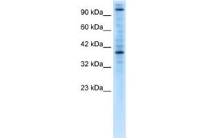 WB Suggested Anti-ZNF624 Antibody Titration:  0. (ZNF624 antibody  (Middle Region))