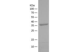 Western Blotting (WB) image for Alpha2 Antiplasmin (SERPINF2) (AA 380-491) protein (His-IF2DI Tag) (ABIN7282074) (alpha 2 Antiplasmin Protein (AA 380-491) (His-IF2DI Tag))
