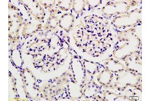 Formalin-fixed and paraffin embedded rat kidney tissue labeled with Rabbit Anti-Podoplanin/gp36 Polyclonal Antibody , Unconjugated 1:200 followed by conjugation to the secondary antibody and DAB staining (Podoplanin antibody  (AA 91-166))
