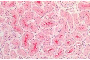 Immunohistochemistry analysis using Rabbit Anti-Tau Polyclonal Antibody (ABIN6698772). (tau antibody  (Biotin))
