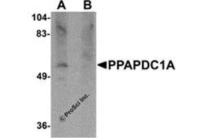 Western Blotting (WB) image for anti-Phosphatidic Acid Phosphatase Type 2 Domain Containing 1A (PPAPDC1A) (C-Term) antibody (ABIN1030596)