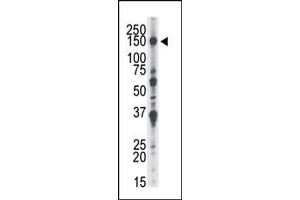 Image no. 2 for anti-NIMA-Related Kinase 1 (NEK1) (AA 1173-1202), (C-Term) antibody (ABIN360536) (NEK1 antibody  (C-Term))