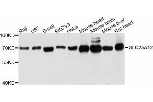 Western blot analysis of extracts of various cell lines, using SLC25A12 antibody (ABIN4905188) at 1:3000 dilution.