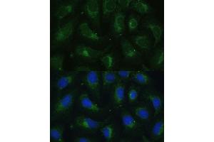 Immunofluorescence analysis of U-2 OS cells using SULT1C4 antibody (ABIN7270631) at dilution of 1:100. (SULT1C4 antibody  (AA 1-95))