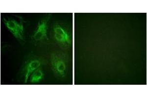 Immunofluorescence analysis of HeLa cells, using Calsenilin/KCNIP3 (Phospho-Ser63) Antibody. (DREAM antibody  (pSer63))