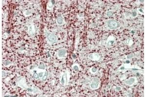 AP21274PU-N TPPP Antibody staining of paraffin embedded Human Cerebral Cortex at 3. (Tppp antibody  (Internal Region))