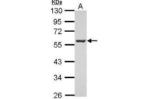 MEF2C antibody