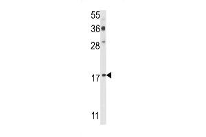 Western blot analysis of PDRG Antibody (N-term) (ABIN390943 and ABIN2841137) in  cell line lysates (35 μg/lane). (PDRG1 antibody  (N-Term))