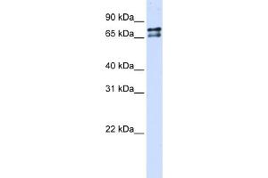 WB Suggested Anti-SF1 Antibody Titration:  0. (Splicing Factor 1 antibody  (N-Term))