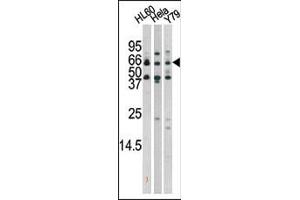 The anti-Phospho-Rad9- Pab (ABIN389631 and ABIN2839627) is used in Western blot to detect Phospho-Rad9- in HL60 (left), Hela(middle), and Y79(right)tissue lysates. (RAD9A antibody  (pSer272))