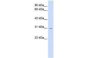 WB Suggested Anti-ZNF501 Antibody Titration:  0. (ZNF501 antibody  (C-Term))