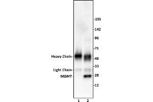 MGMT antibody (pAb) tested by Immunoprecipitation. (MGMT antibody  (C-Term))