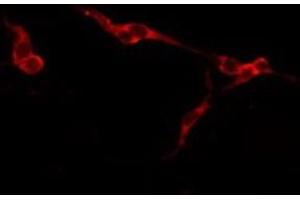 ABIN6277769 staining Hela by IF/ICC. (Aggrecan antibody  (N-Term))