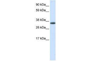 WB Suggested Anti-ERCC8 Antibody Titration:  0. (ERCC8 antibody  (N-Term))