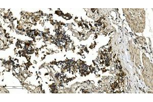 IHC analysis of HDAC4 using anti-HDAC4 antibody (ABIN5518841).