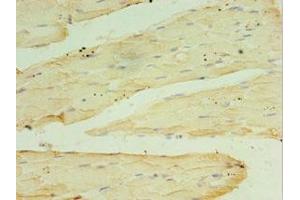 Immunohistochemistry of paraffin-embedded human skeletal muscle tissue using ABIN7166948 at dilution of 1:100 (RPH3AL antibody  (AA 161-315))