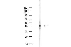 anti-Dehydrogenase/reductase (SDR Family) Member 7 (DHRS7) (C-Term) antibody