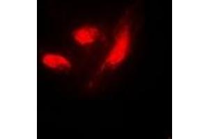 Immunofluorescence (IF) image for anti-Interferon Regulatory Factor 3 (IRF3) (C-Term), (pSer385) antibody (ABIN7303958)
