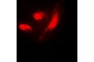 Immunofluorescent analysis of IRF3 (pS385) staining in HeLa cells. (IRF3 antibody  (C-Term, pSer385))