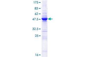 OVCA2 Protein (AA 1-227) (GST tag)