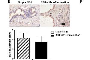 Expression of TLR4, BAMBI, p-Smad2/3 in BPH patient samples. (BAMBI antibody  (AA 101-200))