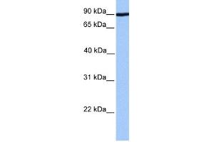 WB Suggested Anti-ADAM2 Antibody Titration: 0. (ADAM2 antibody  (Middle Region))