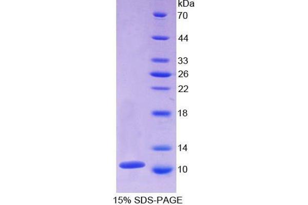 beta-Thromboglobulin Protein (beta-TG)