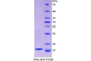 SDS-PAGE analysis of Mouse beta Thromboglobulin Protein. (beta-Thromboglobulin Protein (beta-TG))