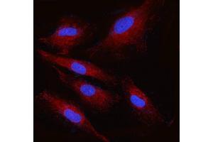 IF analysis of RPN2 using anti-RPN2 antibody (ABIN7602211). (Ribophorin II antibody  (AA 64-174))